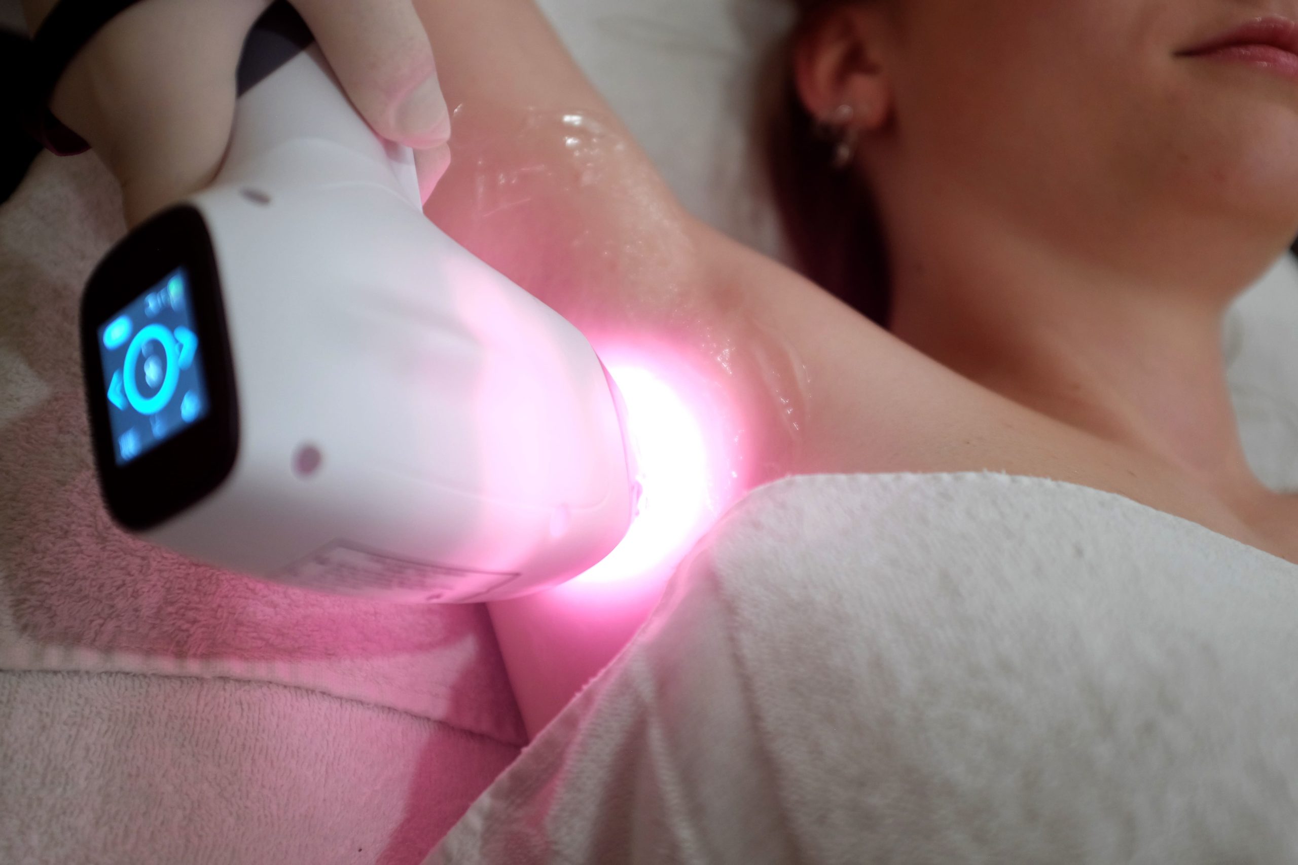 Epilation Laser (consultation)